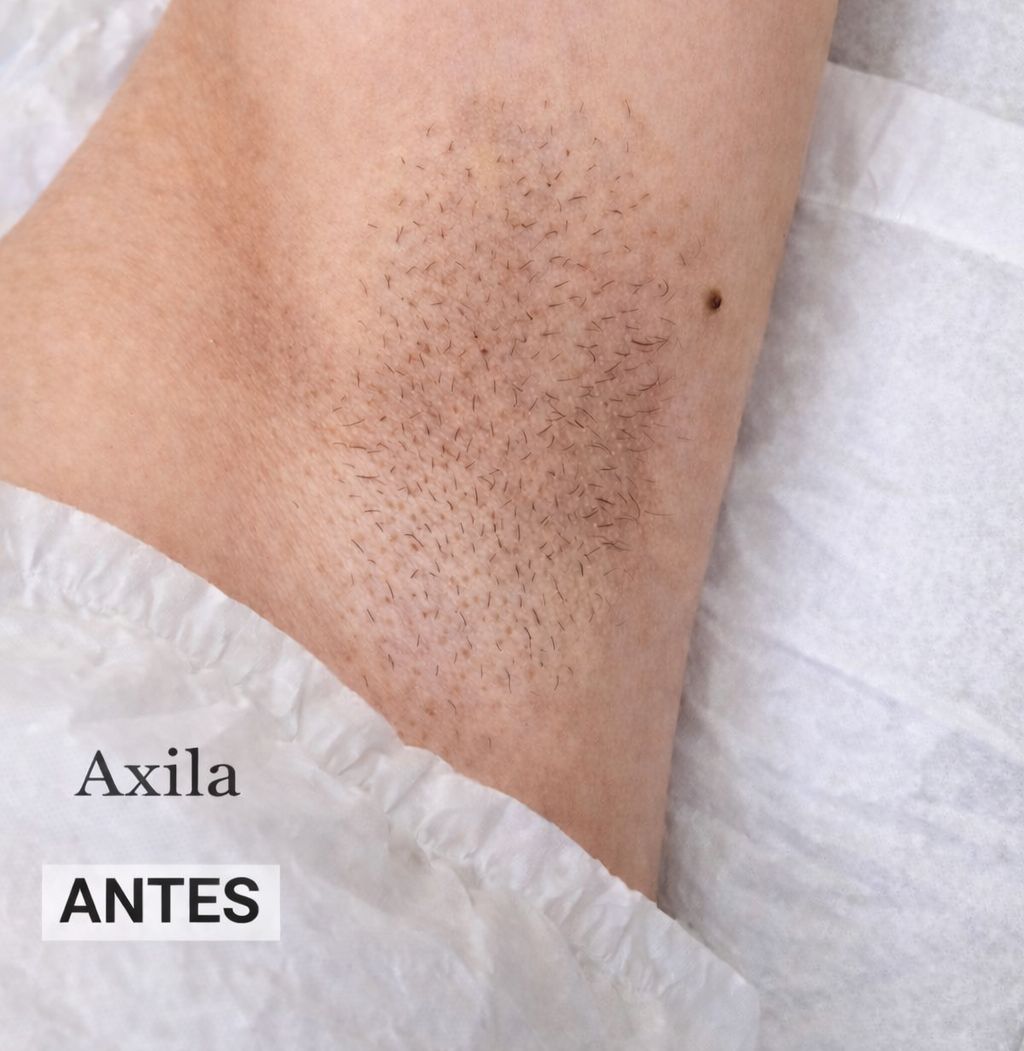 Antes