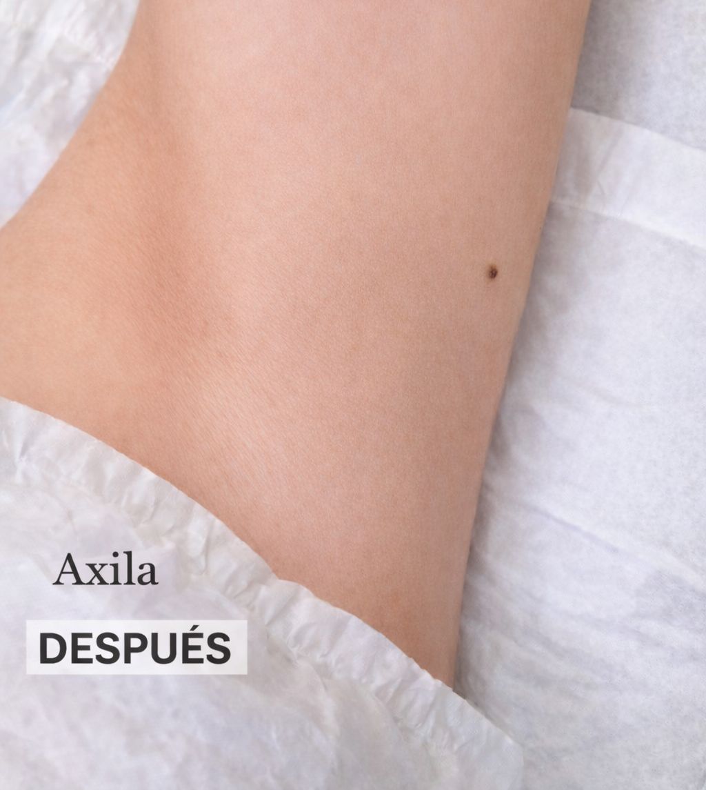 Después